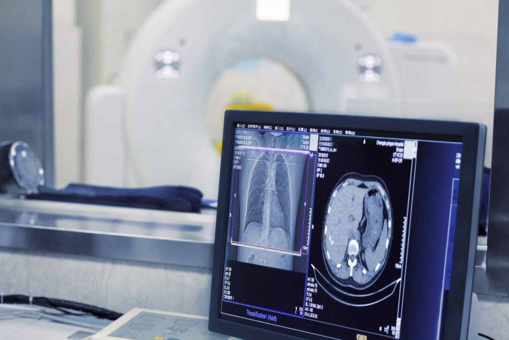 Our CT Scan Services Include