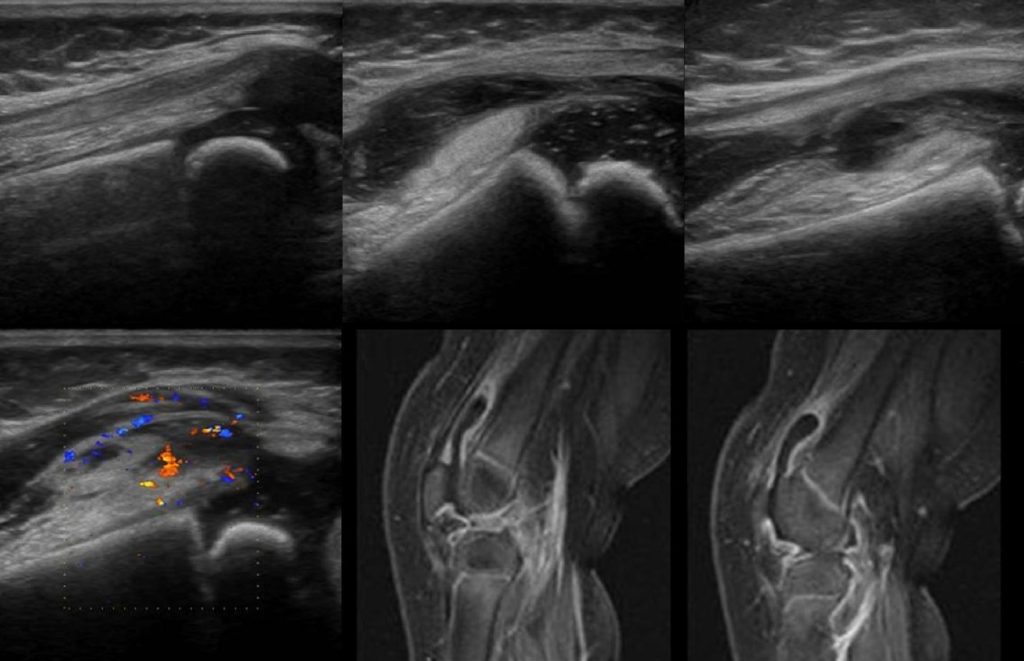 Final Thoughts on Peripheral ultrasound