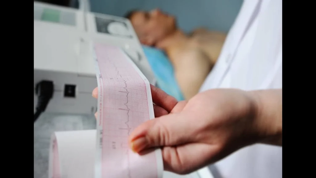 Electrocardiogram test (ECG or EKG test)