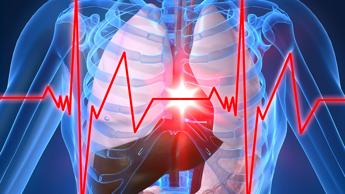 Heart blockage tests andmajor types of tests