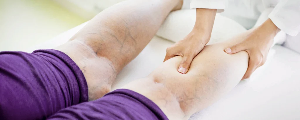 A close-up of a person receiving a therapeutic leg massage with visible veins, symbolizing relaxation, circulation care, and heart check-up awareness.