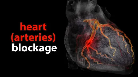 Illustration of a human heart with highlighted arteries showing blockage in red. The text "heart test for blockage" appears on the left against a black background.